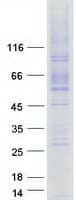 Human LMBRD1 Protein (Recombinant Myc-DDK (Flag))