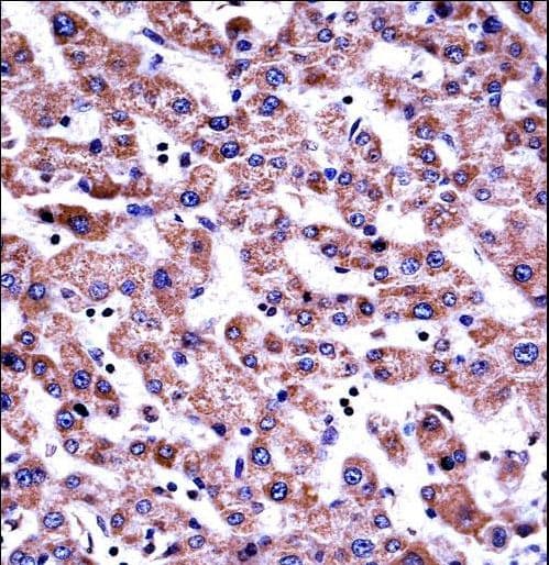 Polyclonal Rabbit anti-Human GDI2 Antibody (aa135-164, IHC, WB)