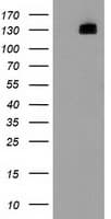 Monoclonal Mouse anti-Human HDAC6 Antibody (clone OTI5E6, IHC, IF, WB)