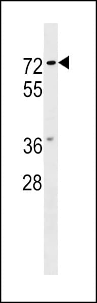 NOTUM Antibody (aa353-379)