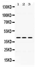 DHODH Antibody