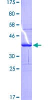 Human HLA-DQB1 Protein (Recombinant GST)