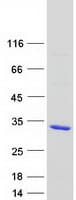Human RAB39 / RAB39A Protein (Recombinant Myc-DDK (Flag))