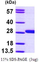 Human GSTM4-4 / GSTM4 Protein (Recombinant His)