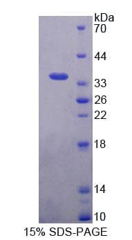 Mouse BAG4 / SODD Protein (Recombinant His-T7, N-terminus)