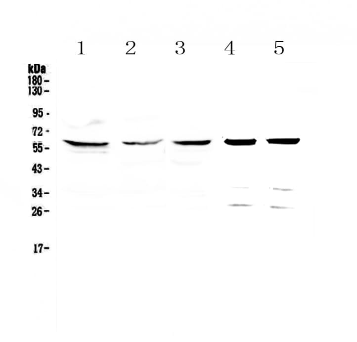 CCT7 Antibody
