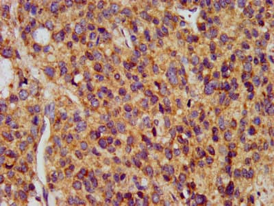 MAP1L / MAP1A Antibody
