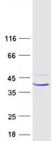 Human CA7 / Carbonic Anhydrase VII Protein (Recombinant Myc-DDK (Flag))