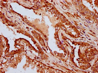 IFT172 Antibody