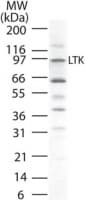 IHC-plus™ LTK Antibody (aa800-864)