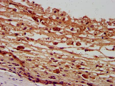 Polyclonal Rabbit anti-Human PANX2 / Pannexin 2 Antibody (IHC, IF, WB)