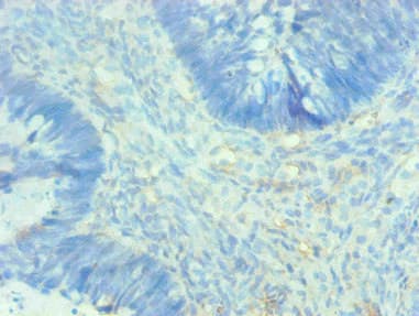 Monoclonal Mouse anti-Human AHSG / Fetuin A Antibody (clone 4A1B5, IHC)