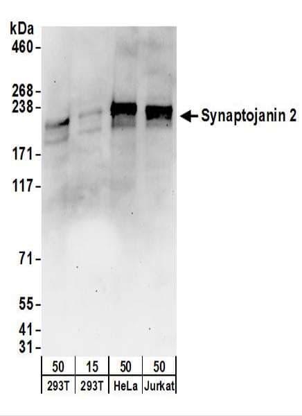 SYNJ2 / Synaptojanin 2 Antibody (aa1275-1325)