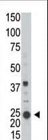 IHC-plus™ Polyclonal Rabbit anti-Human ARFL3 / ARL3 Antibody (aa144-173, IHC, WB)