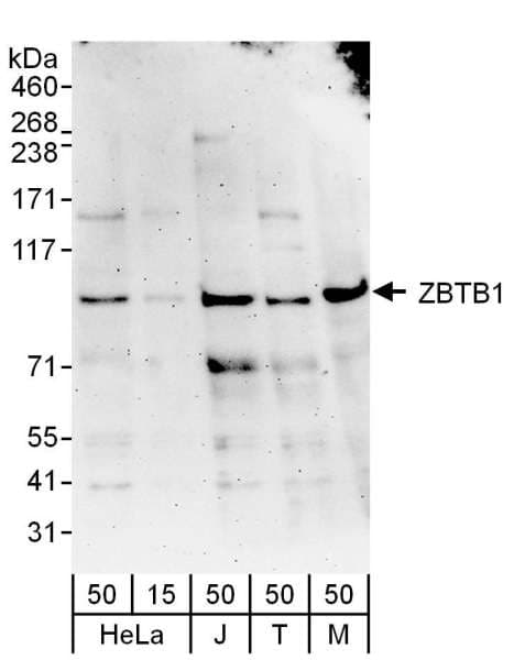 ZBTB1 Antibody (aa663-713)