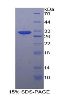 Human FLNB / TAP Protein (Recombinant His)