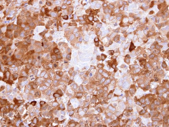 NQO1 Antibody (aa213-274)