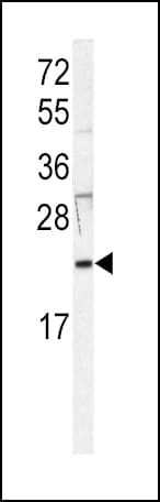 HRAS / H-Ras Antibody (aa104-128)