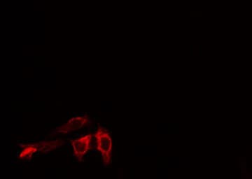 Polyclonal Rabbit anti-Human CASP10 / Caspase 10 Antibody (IHC, IF, WB)