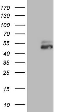 RORB / ROR Beta Antibody (aa1-260, clone OTI1C11, Carrier-free)