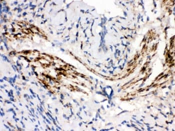 MAOB / Monoamine Oxidase B Antibody