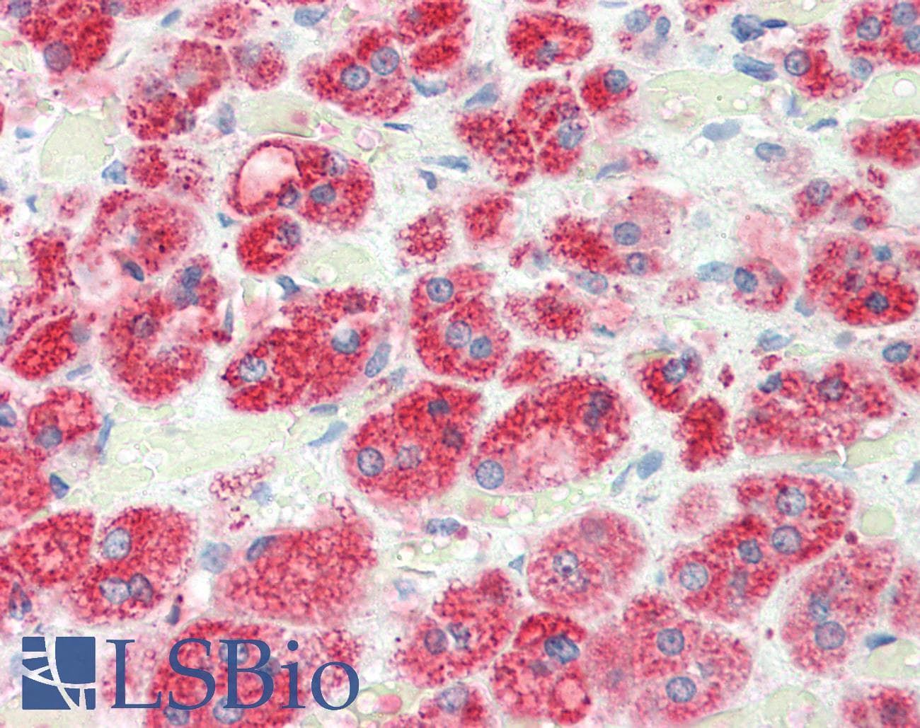 Polyclonal Rabbit anti-Human RGS5 Antibody (aa30-80, IHC, WB)
