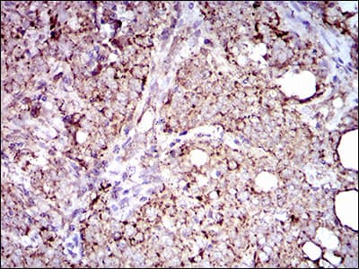 ALDH2 Antibody (aa317-517, clone 4G6A3)