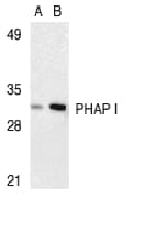 PHAP1 / ANP32A Antibody