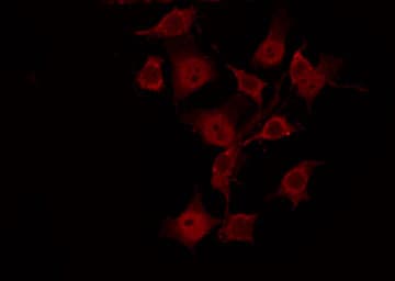 SGK1 / SGK Antibody