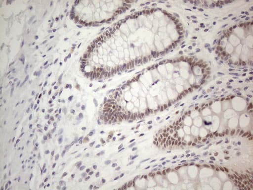 TDG / Thymine DNA Glycosylase Antibody (aa160-253, clone OTI3C11)