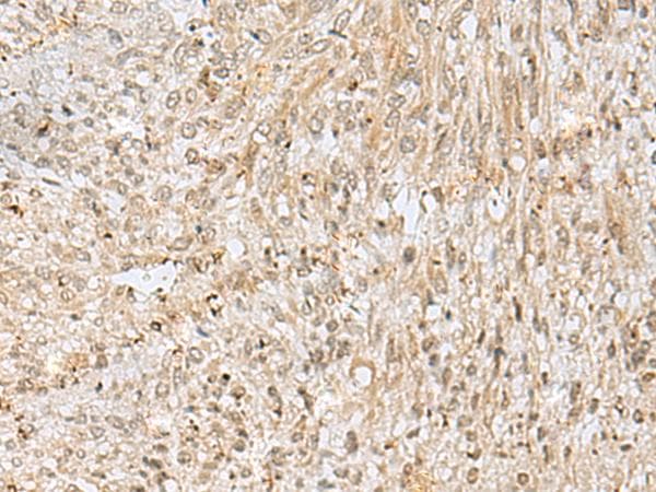 NUPL1 Antibody