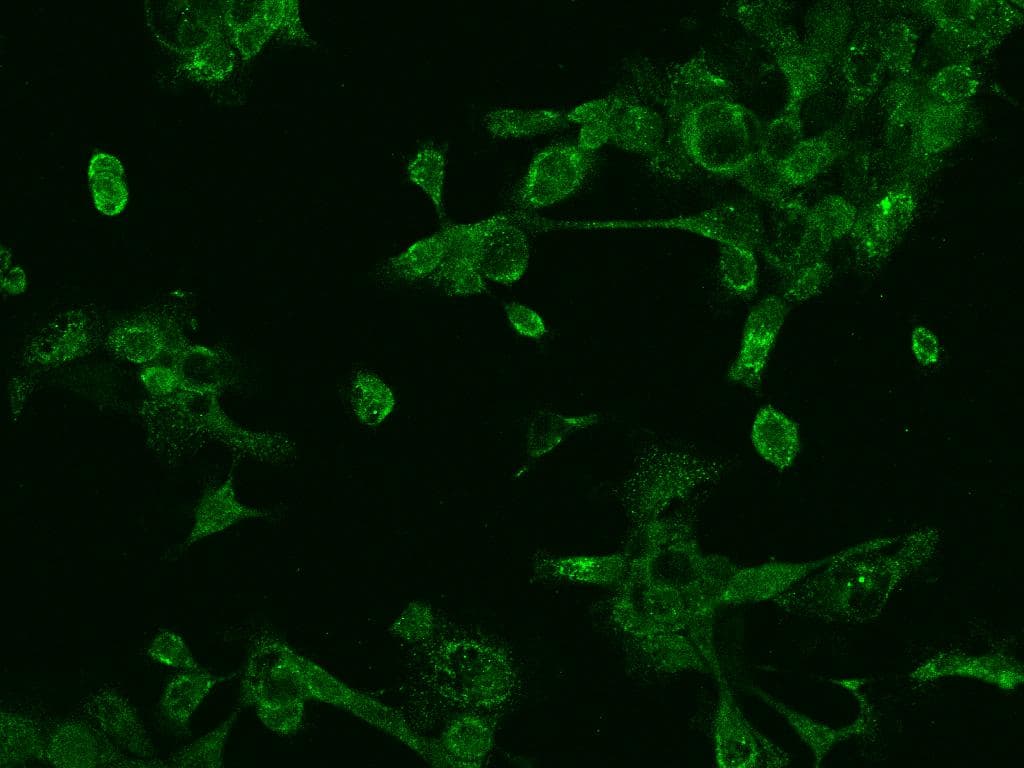 PREX1 / P-REX1 Antibody
