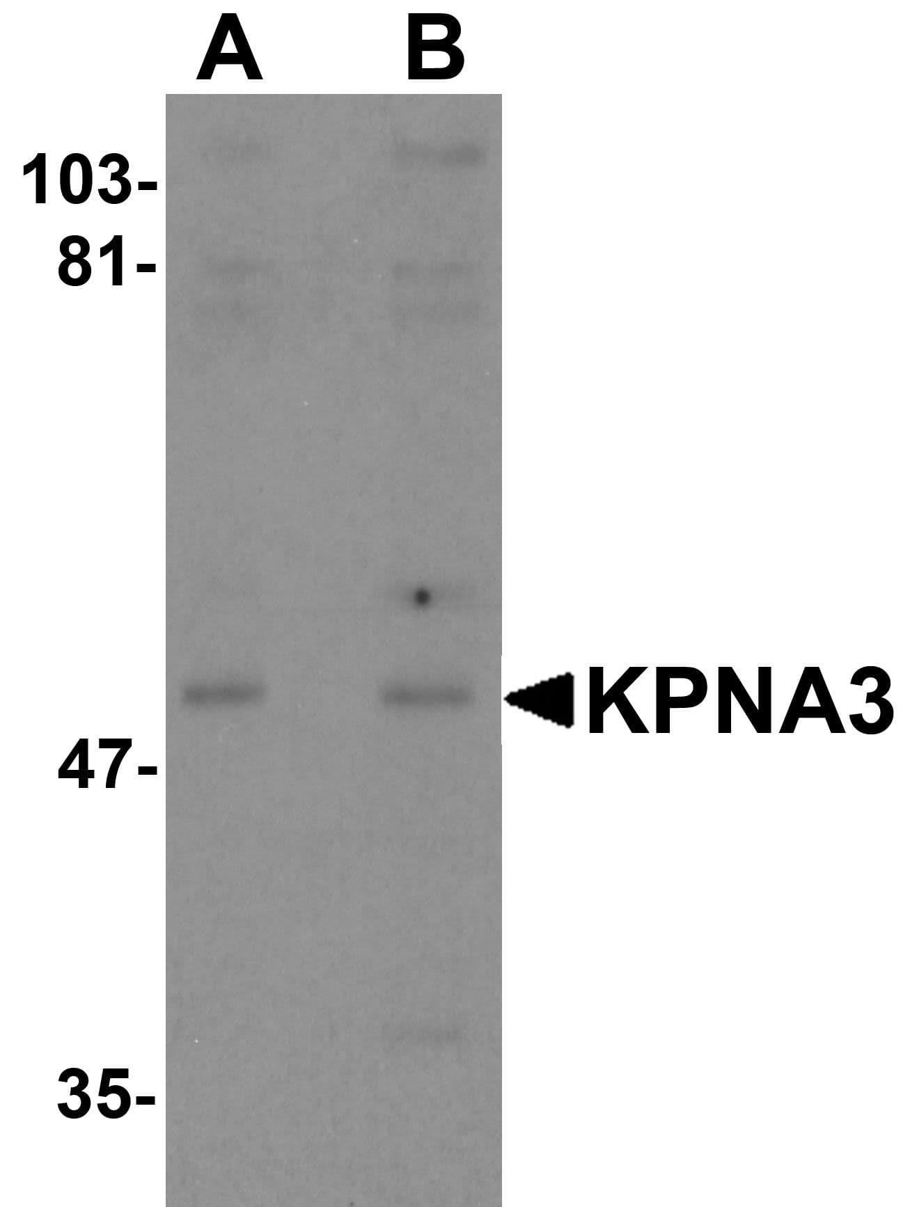 IHC-plus™ Polyclonal Rabbit anti-Human KPNA3 / Importin Alpha 4 Antibody (IHC, IF, WB)