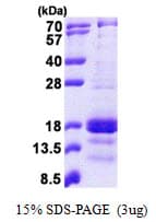 Human CXCL9 / MIG Protein (Recombinant His)