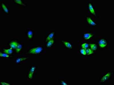 F8 / FVIII / Factor VIII Antibody