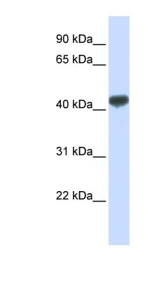 ZRANB2 / ZNF265 Antibody (aa72-121)