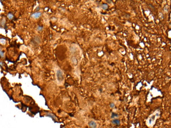 PEAR1 Antibody