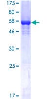 Human SRM / Spermidine Synthase Protein (Recombinant GST)