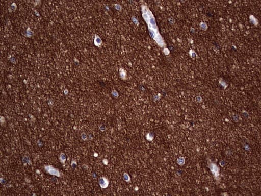 Monoclonal Mouse anti-Human NCAM / CD56 Antibody (clone OTI3H2, Carrier-free, aa20-718, IHC, WB)