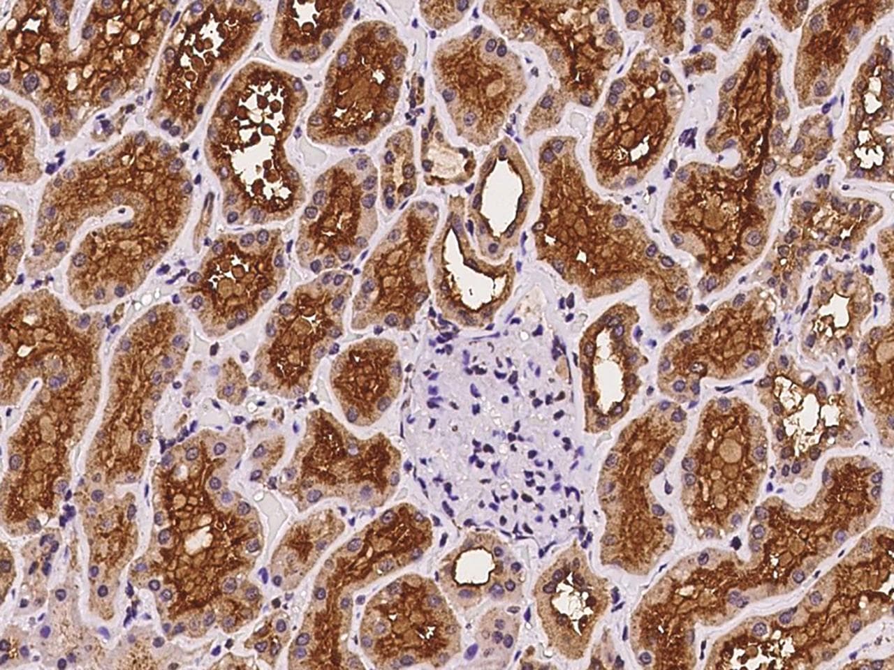 NPHP1 / Nephronophthisis Antibody