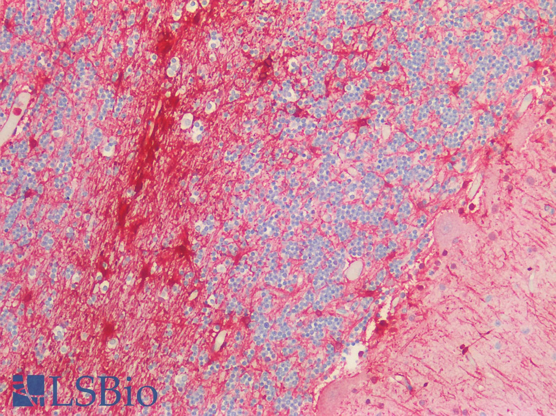 IHC-plus™ GFAP Antibody (C-terminal domain of human)