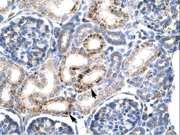 PAX4 Antibody (aa166-215, HRP)