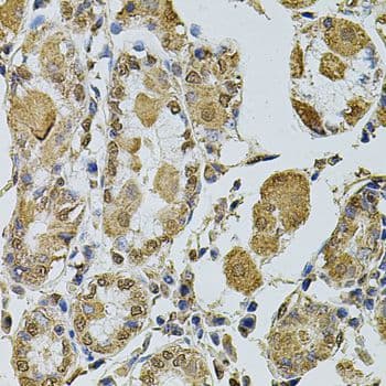 CCNA2 / Cyclin A2 Antibody