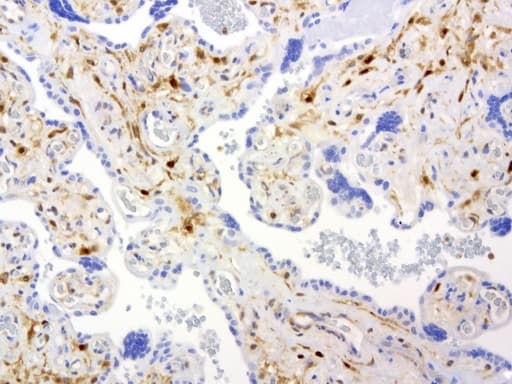 Monoclonal Mouse anti-Human TP / Thymidine Phosphorylase Antibody (clone UMAB90, Carrier-free, aa311-482, IHC, WB)