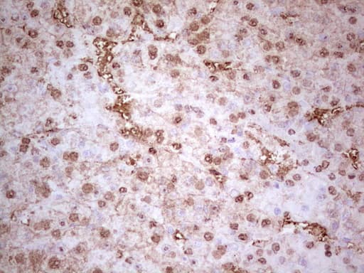 MTOR Antibody (aa1766-2144, clone OTI3E5)