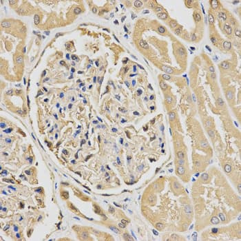 HUS1 Antibody