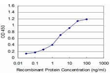 MECP2 Antibody (clone 1B11)
