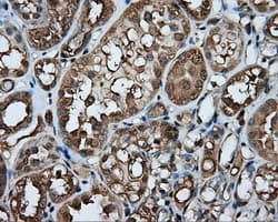 Monoclonal Mouse anti-Human PPP5C Antibody (clone OTI4E1, IHC, WB)