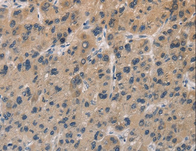 Polyclonal Rabbit anti-Human DUSP26 / MKP8 Antibody (IHC)
