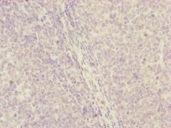 CENPH / CENP-H Antibody
